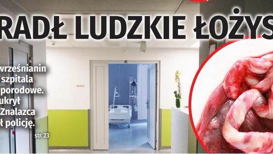 Ukradł ludzkie łożysko!