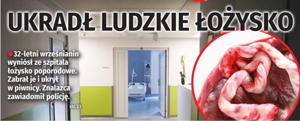 Ukradł ludzkie łożysko!